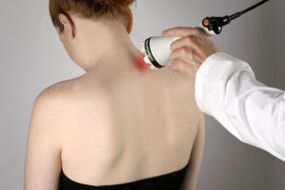 Terapia a laser