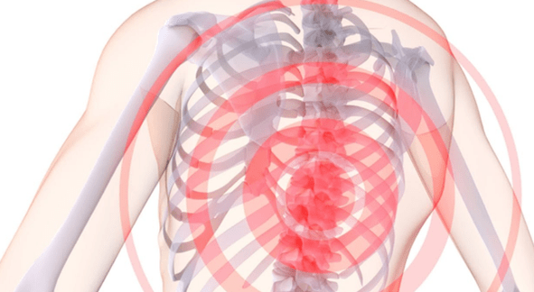 Dor na coluna com osteocondrose torácica