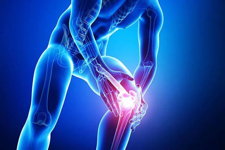 Sintomas de osteoartrite
