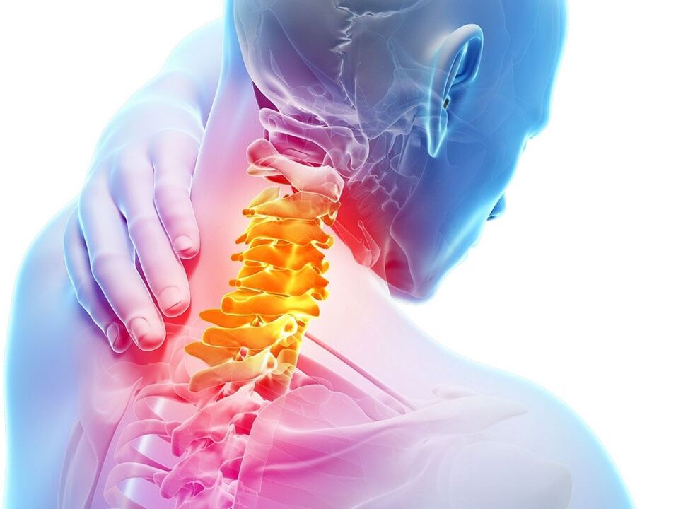 Osteocondrose da coluna cervical